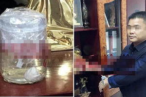 Vụ Giám đốc ép người tình của vợ chặt đứt đốt ngón tay ở Quảng Ninh bây giờ thế nào?