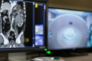 AI mất 20 giây để chẩn đoán bệnh nhân mắc Covid-19