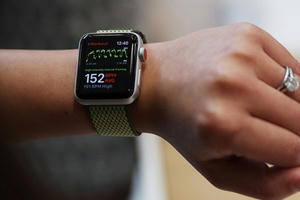 Apple có thể trang bị camera cho đồng hồ Watch