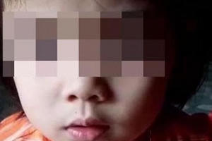 Cô giáo tường trình vụ nhét chất bẩn vào vùng kín bé gái mầm non