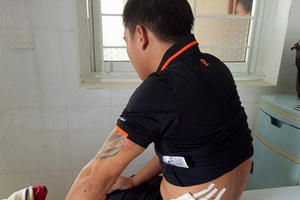 Truy sát bằng súng tại quán Karaoke, 4 người nhập viện