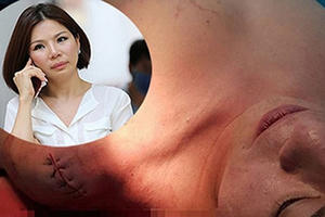 Thông tin mới vụ bác sĩ Chiêm Quốc Thái bị truy sát giữa trung tâm Sài Gòn