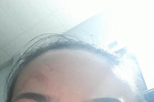 Kon Tum: Cần xử lý nghiêm vụ Công ty TNHH Tài Hồng Nhung thuê “giang hồ” hành hung người dân