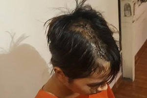 Vụ thiếu nữ 14 tuổi bị nhóm thanh niên truy sát giữa khuya: Nghi vấn chém nhầm người