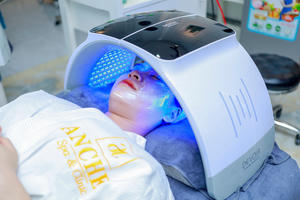 Anchee Clinic TPHCM: Bão sale tháng 10 - Giảm đến 50% dịch vụ điều trị mụn