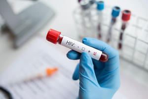 Điều kiện xác định người bị phơi nhiễm với HIV do tai nạn rủi ro nghề nghiệp