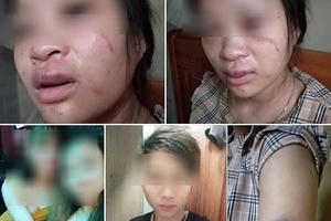 Bị chồng đánh tới tấp dù mang thai sắp sinh vì… mua giày với giá 135.000 đồng?!