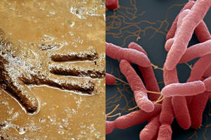 Whitmore xuất hiện ở nhiều tỉnh, những ai dễ mắc bệnh?