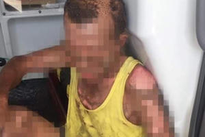 Đang ăn cơm trưa, con đổ xăng lên người bố đẻ rồi châm lửa cùng tự thiêu