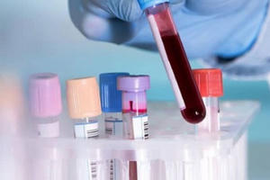 Chuyên gia phải được xét nghiệm Covid-19 trước khi nhập cảnh vào Việt Nam