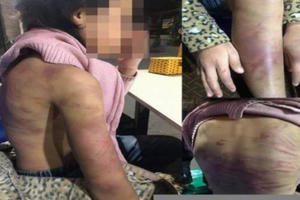 Hội Phụ nữ đề nghị xử lý nghiêm đối tượng bạo hành và xâm hại bé gái 12 tuổi