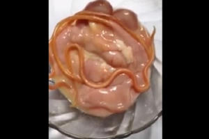 Kinh hoàng với clip giun sán ngọ nguậy trong lòng lợn