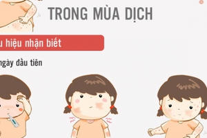 Inforgraphics: Bí kíp sống khỏe giữa mùa dịch thủy đậu Inforgraphics: Bí kíp sống khỏe giữa mùa dịch thủy đậu