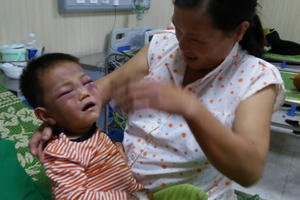 Không truy cứu trách nhiệm hình sự người cha dượng đánh con riêng của vợ nhập viện