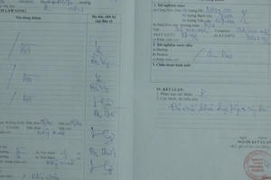 Vụ GKSK bán ở cửa hàng tạp hóa trước cổng bệnh viện: Công an vào cuộc điều tra