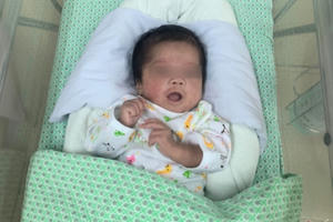 Thai nhi 1,6kg bị phá bỏ ở tuần thai 31 sống lại kỳ diệu