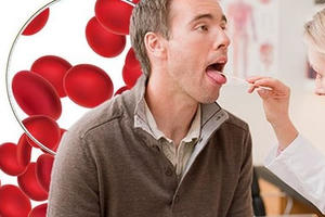 Dấu hiệu cho biết bạn đang thiếu vitamin B12 và thiếu máu