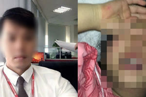 Ảnh kẻ xâm hại tình dục bé gái 8 tuổi ở Hà Nội bị phát tán khắp Facebook