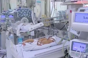 Đã xác định được nguyên nhân hàng loạt trẻ nhập viện do nhiễm "virus lạ"