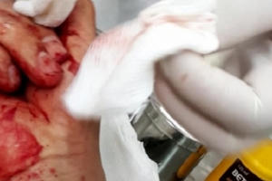 Kẻ hành hung nhà báo Đỗ Doãn Hoàng sẽ phải "bóc lịch" bao lâu?