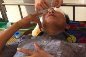 Nghệ An: Làm đơn tố cáo, một ứng viên trưởng thôn bị hất chất lạ vào mặt