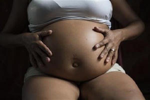 Tranh cãi về đề xuất cho phép phá thai nếu nhiễm virus Zika