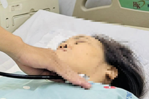 Cứu sống nữ bệnh nhân uống 113 viên thuốc cùng lúc