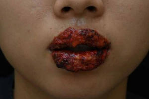 “Suýt” mất môi vì... xăm giá rẻ