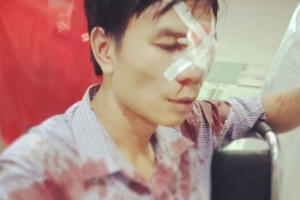 Công an huyện Quỳnh Lưu vào cuộc vụ cán bộ địa chính bị tố đánh gục người sau va chạm giao thông?