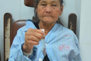 Nội soi phát hiện đỉa dài 7cm hút no máu trong đường thở của bệnh nhân