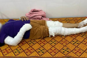 Dựng cây nêu đón Tết, nhóm người bị điện giật cháy xém