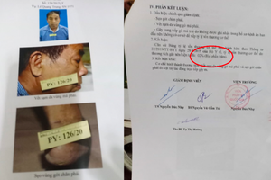 Cần sớm làm rõ vụ việc một công dân ở Hải Phòng bị hành hung, phá hủy tài sản