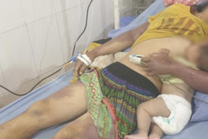 Sơn La: Điều tra vụ việc chồng dùng củi đánh vợ nhập viện cấp cứu trong tình trạng đa chấn thương