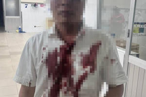 Đà Lạt: Công an đang truy xét nhóm côn đồ hành hung người dân tại quán nhậu