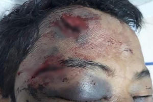 Đến nhà con nợ uống rượu, chủ nợ bị trói đánh bầm dập