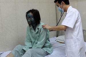 Bà bầu mắc thủy đậu cẩn thận nguy hiểm cho thai nhi Bà bầu mắc thủy đậu cẩn thận nguy hiểm cho thai nhi