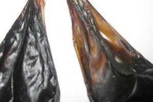 Nuốt túi mật lợn chữa đau bụng, nữ sản phụ suýt tử vong