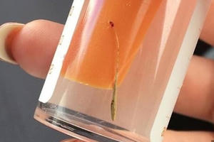 Cây mọc xanh mướt trong lỗ tai thiếu nữ