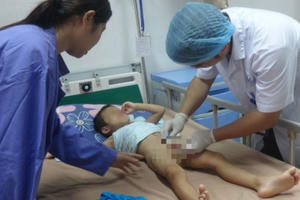 Công bố nguyên nhân gần 40 trẻ mắc sùi mào gà vào ngày mai?