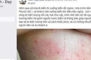 Tắm biển bị ngứa, nổi dị ứng tại Đà Nẵng: Có thể do sao biển và sứa