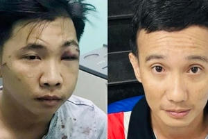 Bình Dương: Bắt giữ 2 nghi phạm chém người sau tai nạn giao thông