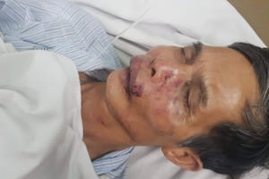 Phóng viên Tạp chí Luật sư Việt Nam bị đánh chấn thương sọ não do phát hiện xe chở gỗ không rõ nguồn gốc?