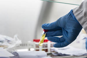 Nam bệnh nhân tử vong do cúm A/H1 pdm tại Bình Định