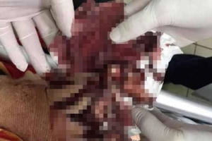 Nổ lớn tại chung cư ở TP Vinh, 1 người nát bàn tay