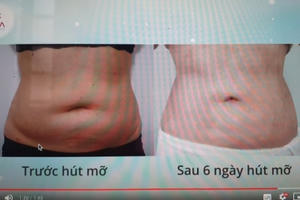 TP HCM: Thẩm mỹ Quốc tế Diva quảng cáo dịch vụ "chui" còn “nổ” đã được Sở Y tế cấp phép