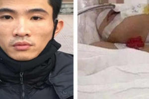 Thông tin mới nhất mới về vụ bé gái bị người tình của mẹ đóng 9 cái đinh vào đầu