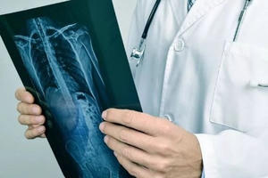 COVID-19: 3 dấu hiệu cho thấy nhiễm trùng đã ảnh hưởng đến phổi