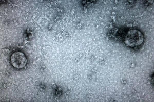 Quá trình nuôi cấy và phân lập thành công virus nCoV ở Việt Nam Quá trình nuôi cấy và phân lập thành công virus nCoV ở Việt Nam