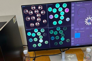 Bắt giữ đối tượng người nước ngoài vận chuyển trái phép hơn 700 viên kim cương Bắt giữ đối tượng người nước ngoài vận chuyển trái phép hơn 700 viên kim cương