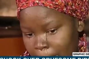 Người mẹ chết lặng khi con sinh ra chỉ có đầu